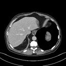 CT slice of the abdomen